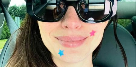 Los parches para granitos en forma de corazones o estrellas que han cambiado las reglas del juego: “Su fórmula con hidrocoloide reducen la inflamación y combaten la aparición de espinillas”
