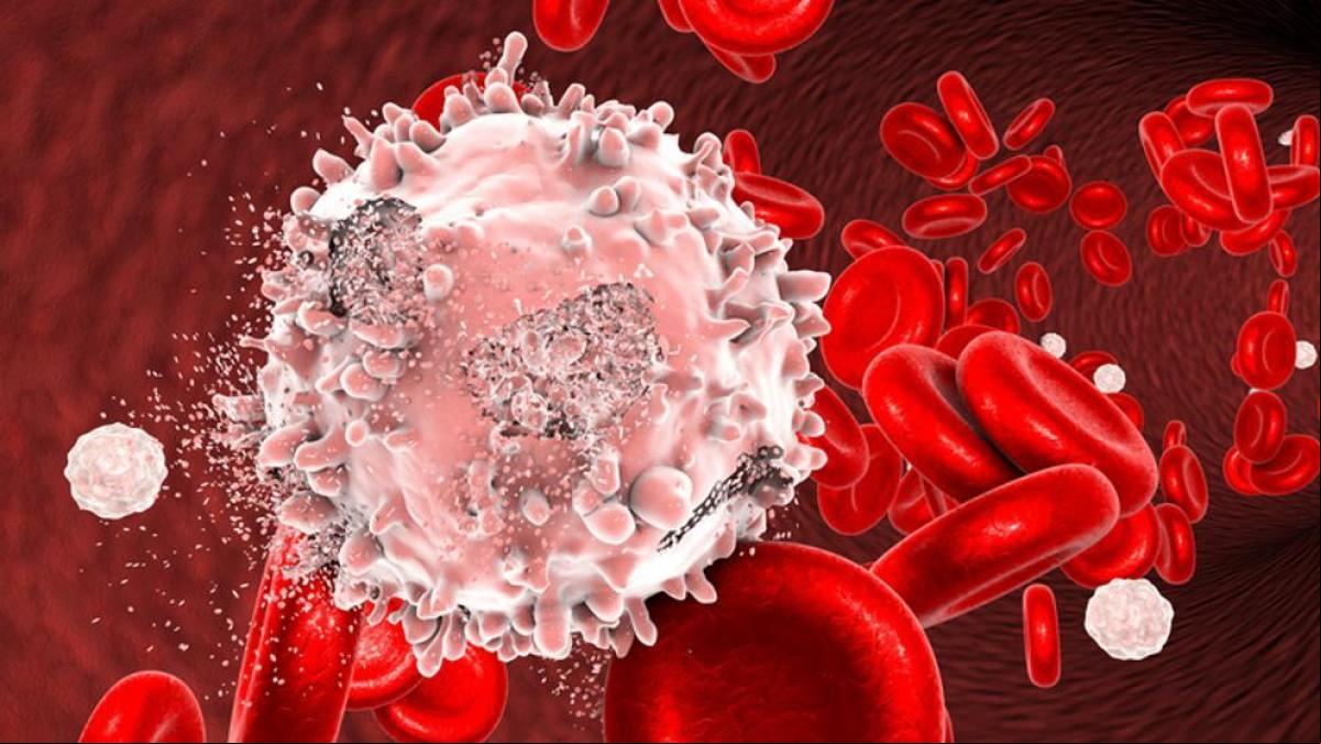 ¿Un nuevo tipo de fármacos contra la leucemia mieloide aguda?