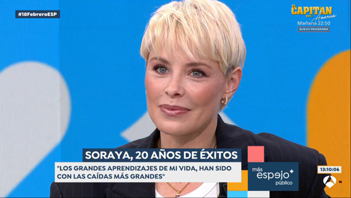 Soraya se abre en canal y confiesa el motivo por el que tuvo que someterse a varias cirugías estéticas tras Operación Triunfo: Nunca he tenido miedo a los cambios